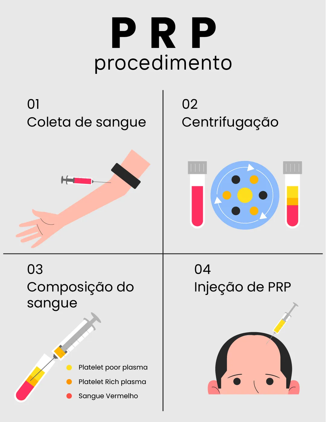prp procedure 