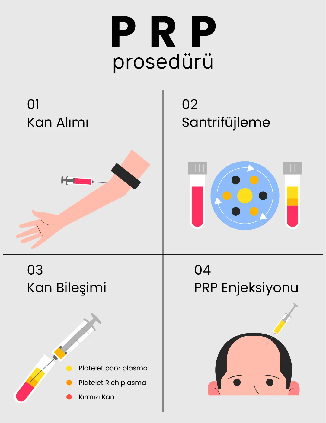 prp procedure 