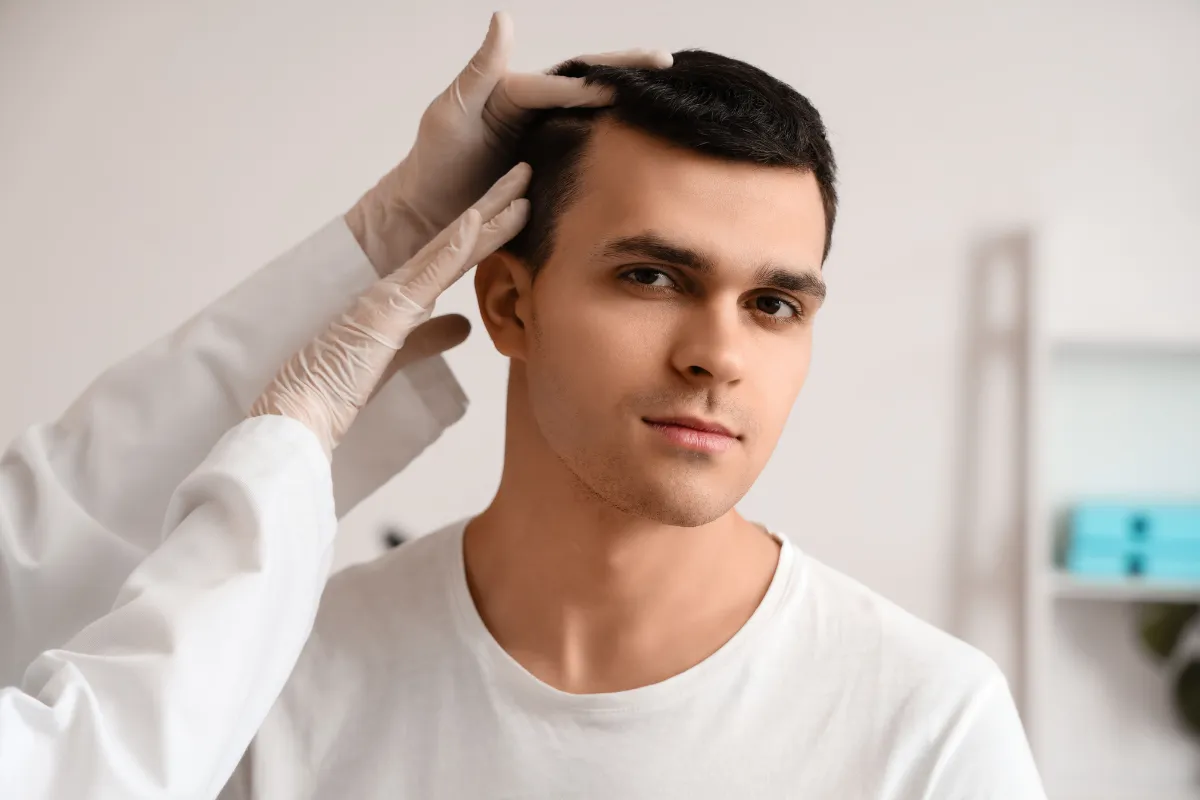 receding hairline