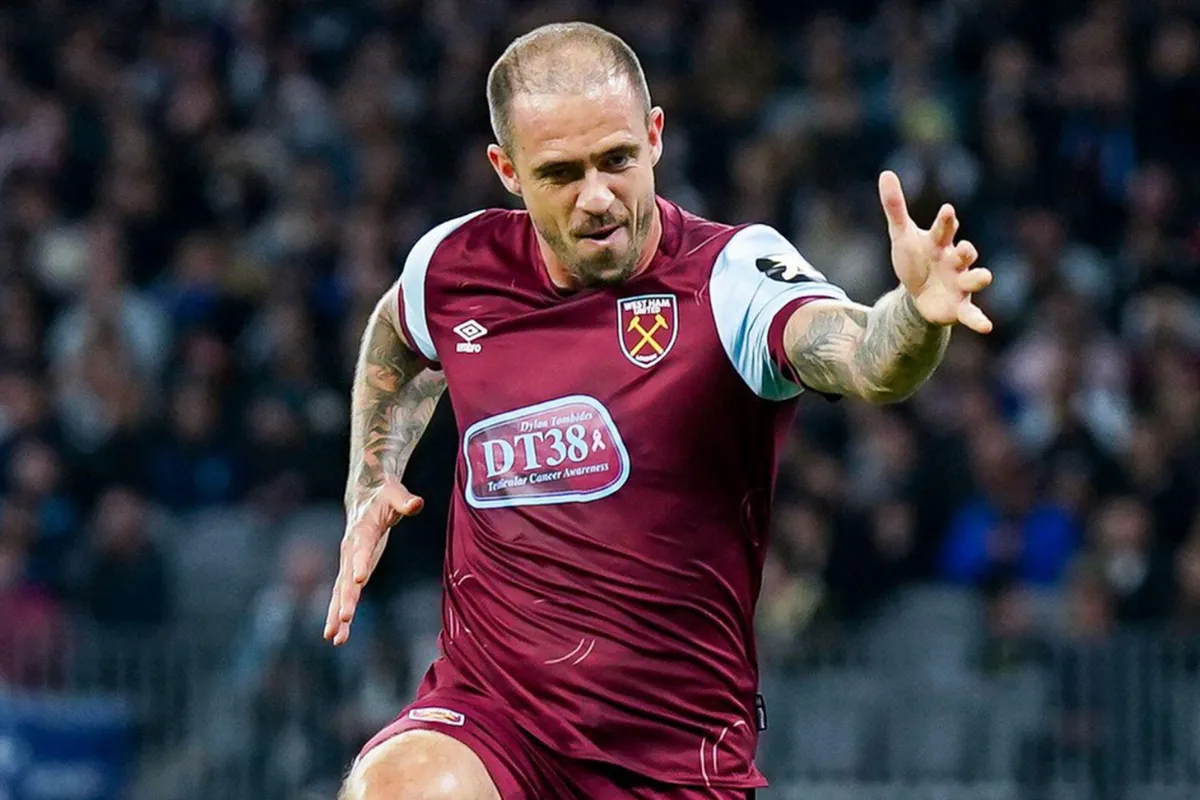 Did Danny Ings Have a Hair Transplant 1