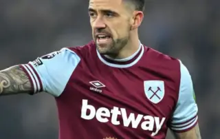 Did Danny Ings Have a Hair Transplant F
