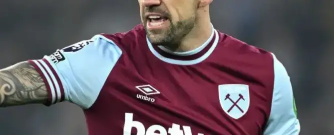 Did Danny Ings Have a Hair Transplant F