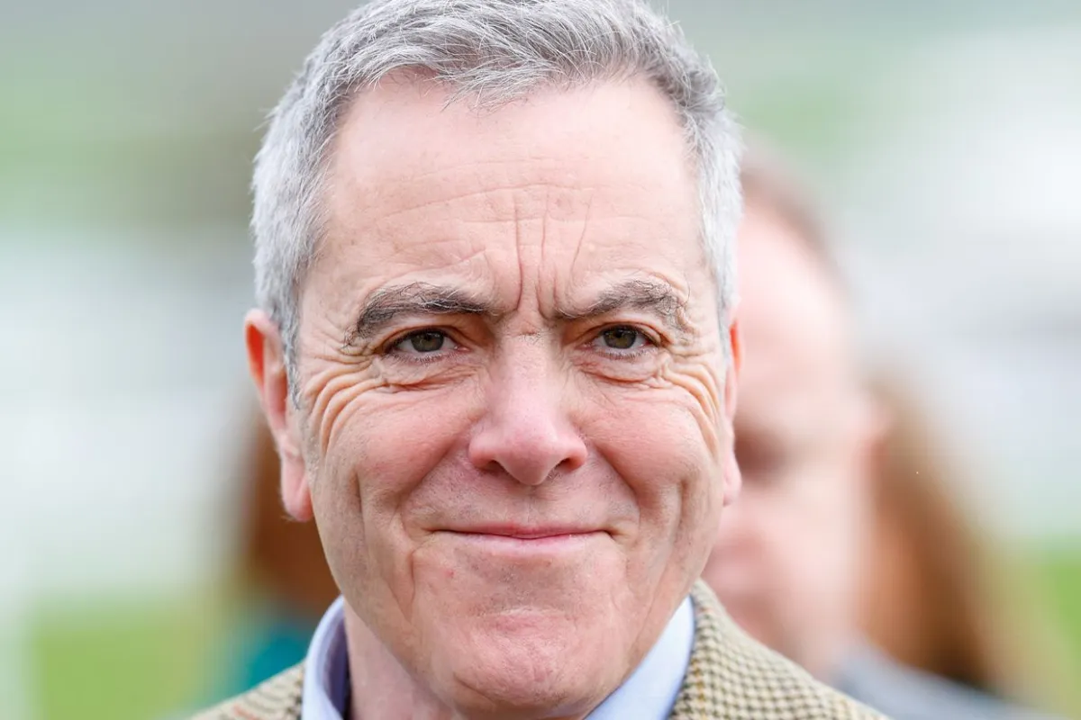 Did James Nesbitt Have a Hair Transplant 1