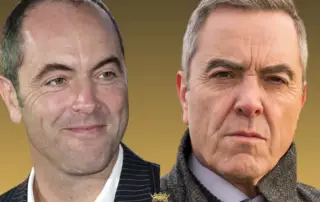 Did James Nesbitt Have a Hair Transplant F