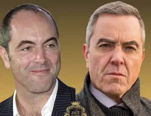¿Se sometió James Nesbitt a un trasplante capilar?