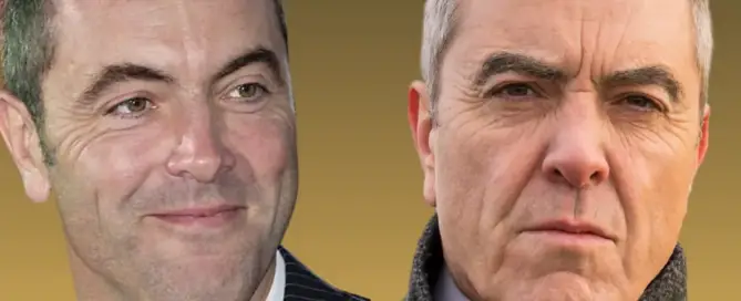 Did James Nesbitt Have a Hair Transplant F