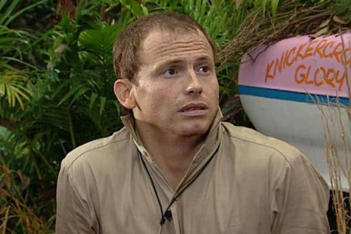 Did Joe Swash Have a Hair Transplant 1