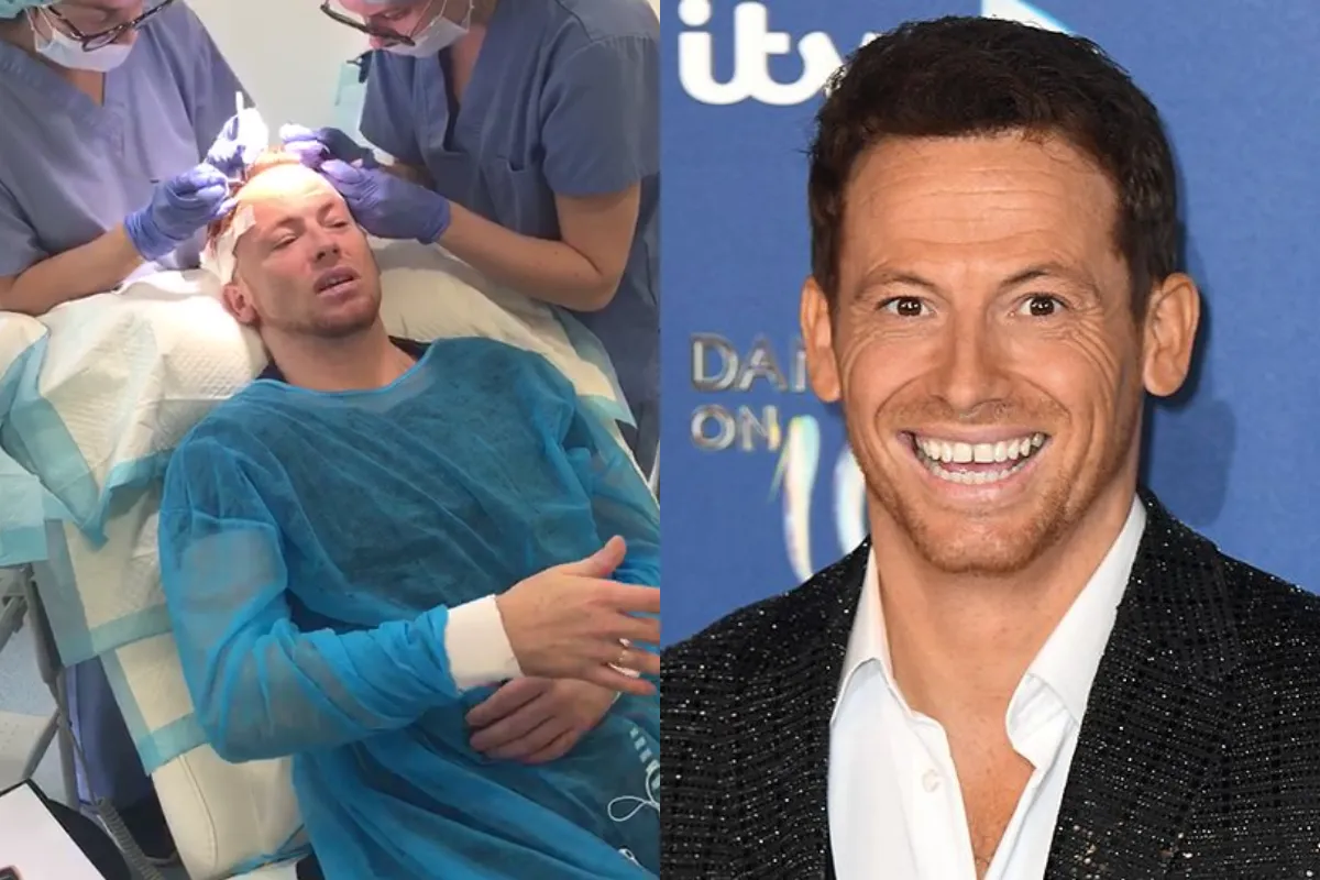 Did Joe Swash Have a Hair Transplant 2