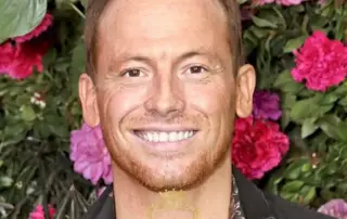 Did Joe Swash Have a Hair Transplant F