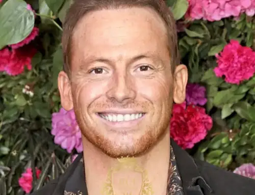 ¿Se sometió Joe Swash a un trasplante capilar?