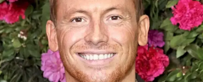 Did Joe Swash Have a Hair Transplant F