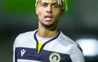 Did Ouzy See Get a Hair Transplant F