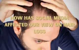 How Has Social Media Affected Our View on Hair Loss f