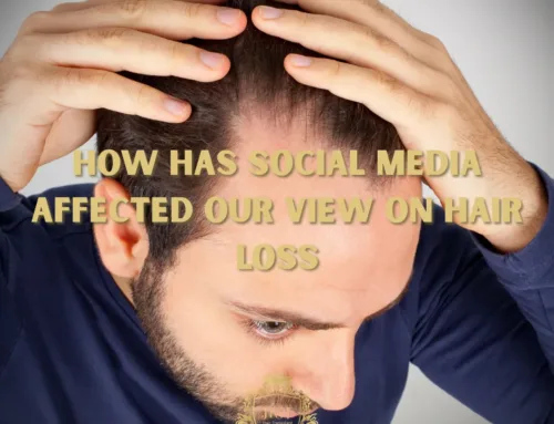 Comment les réseaux sociaux ont-ils influencé notre perception de la perte de cheveux ?