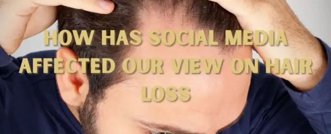 How Has Social Media Affected Our View on Hair Loss f