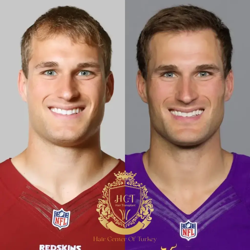 Kirk Cousins F