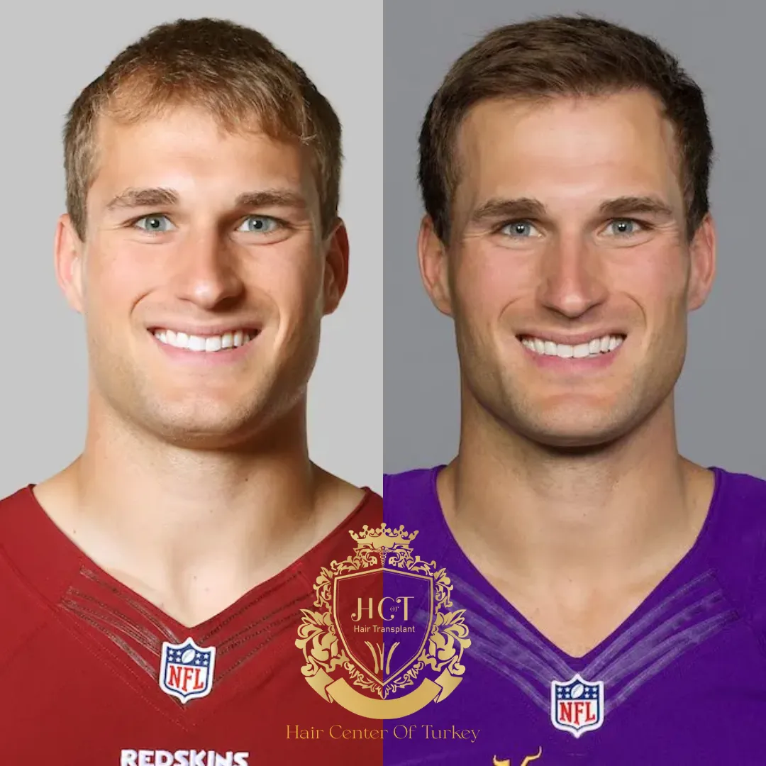 Kirk Cousins F