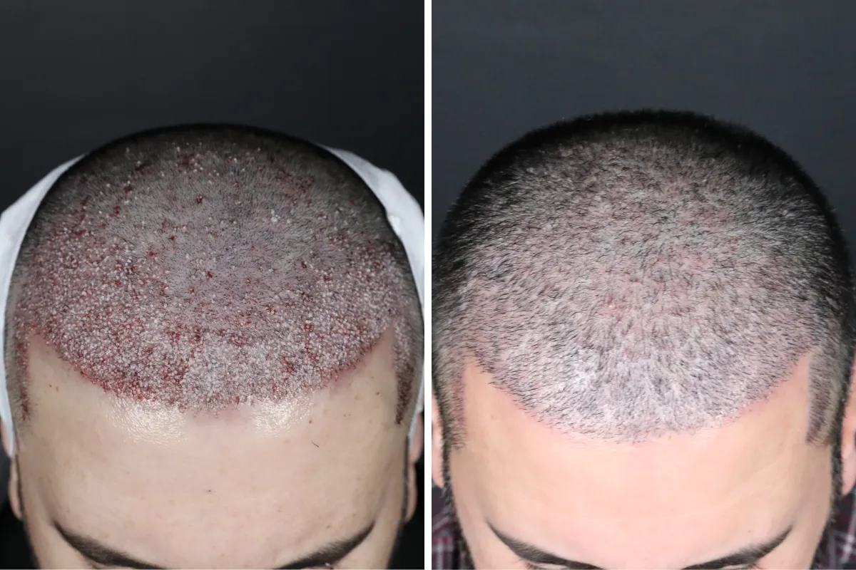 What is good for gray hair