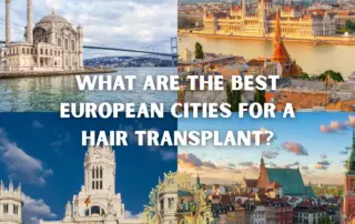 What Are the Best European Cities for a Hair Transplant F