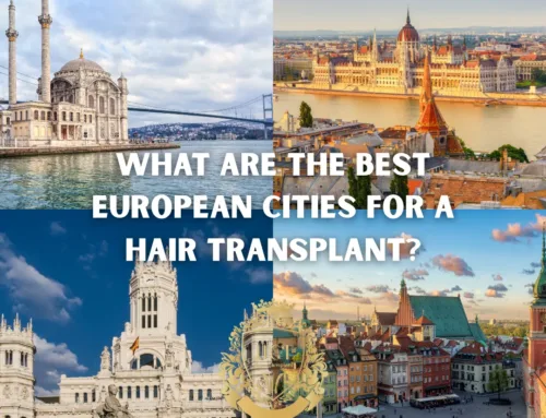 Quelles sont les meilleures villes européennes pour une greffe de cheveux ?