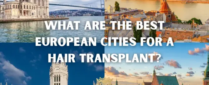 What Are the Best European Cities for a Hair Transplant F