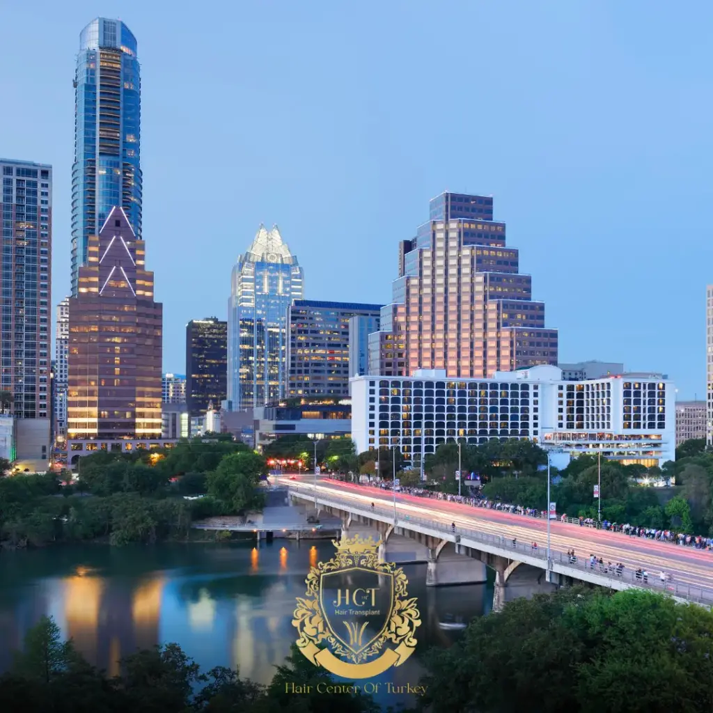 What Are the Best Hair Transplant Clinics in Austin F