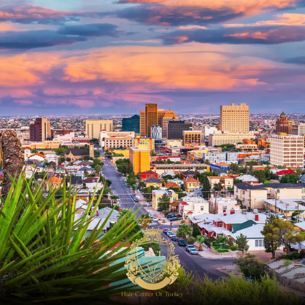 What Are the Best Hair Transplant Clinics in El Paso F