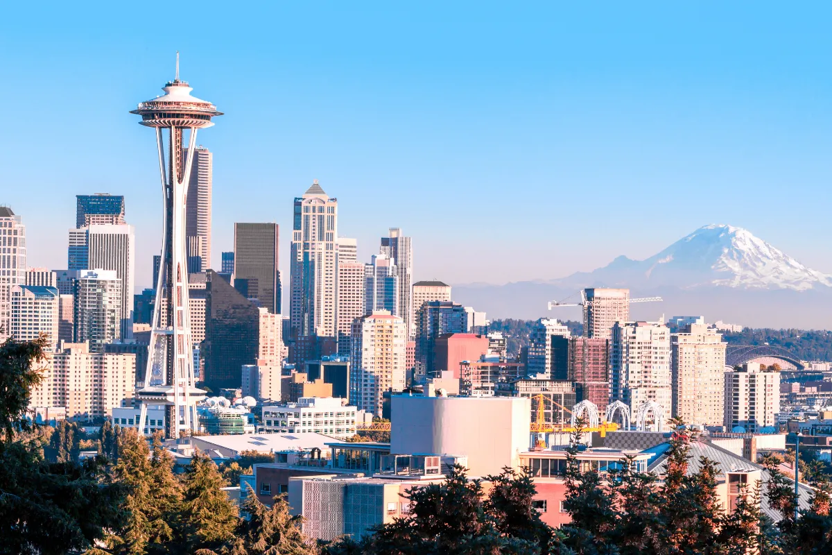 What Are the Best Hair Transplant Clinics in Seattle 1 receding hairline