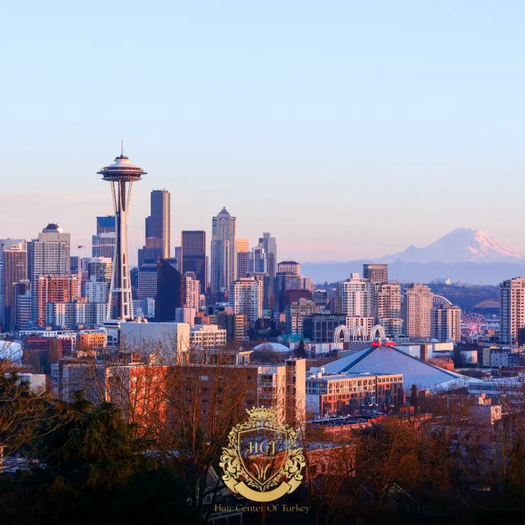 What Are the Best Hair Transplant Clinics in Seattle F
