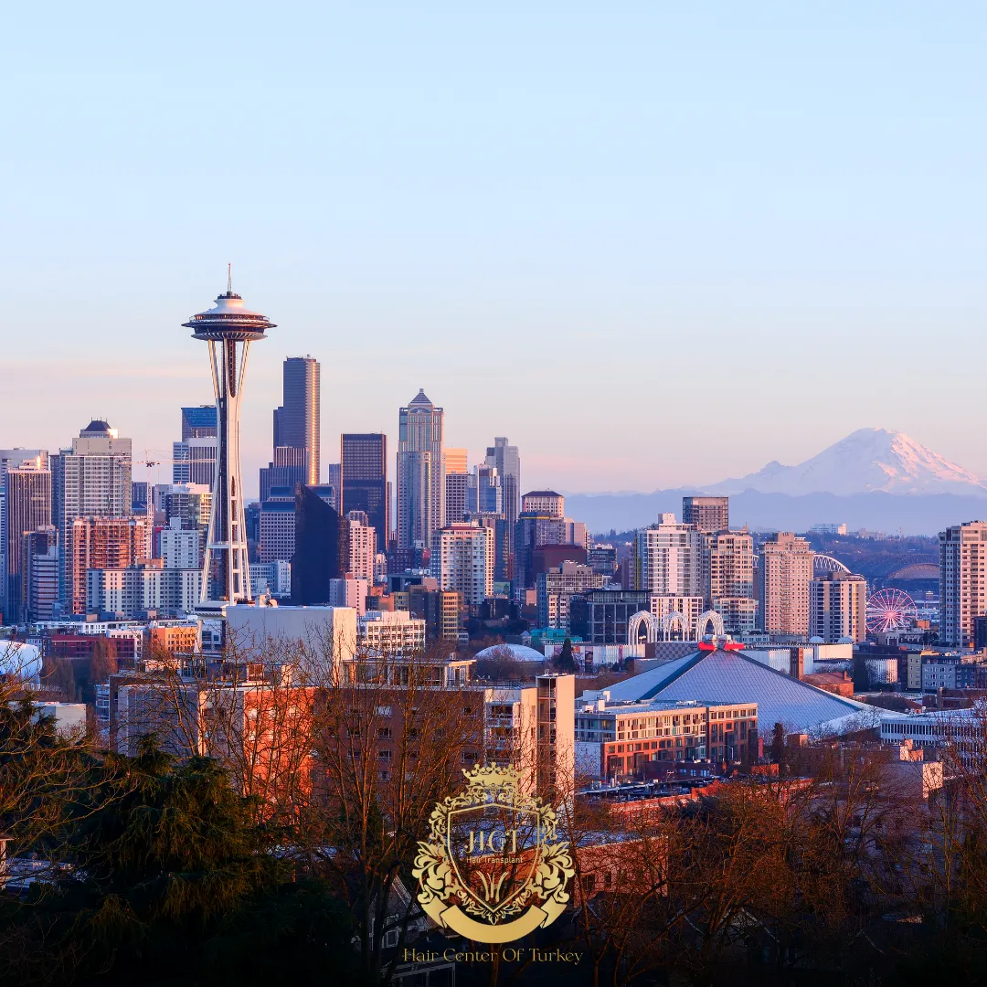 What Are the Best Hair Transplant Clinics in Seattle F