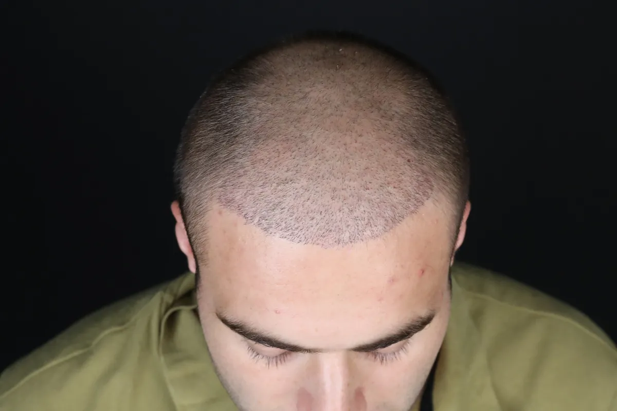 What is good for gray hair