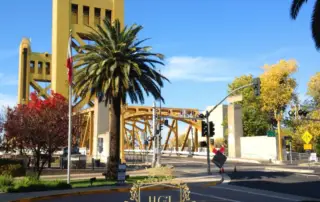 What Are the Best Hair Transplant Clinics in Sacramento F