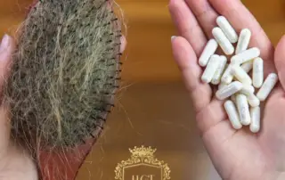 What Are the Best Vitamin Supplements for Hair Loss F