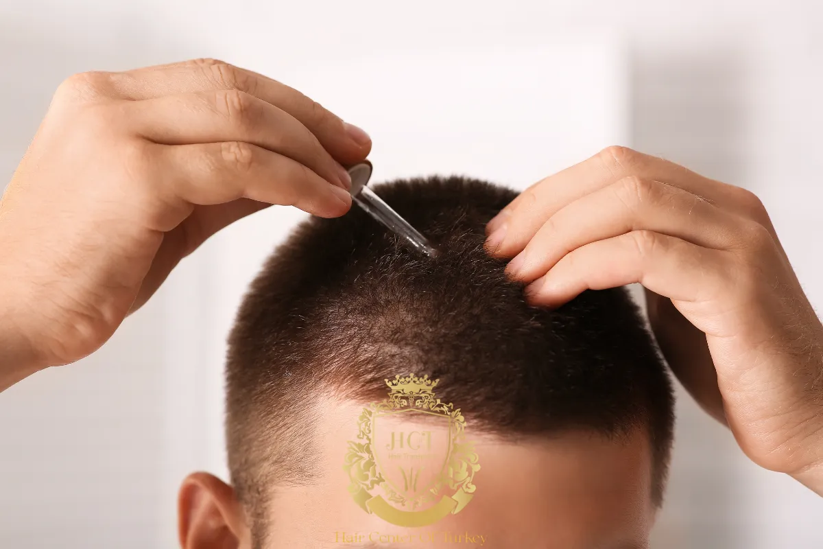receding hairline