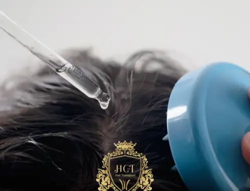 ¿Cuáles son los remedios naturales para reducir la caída del cabello?