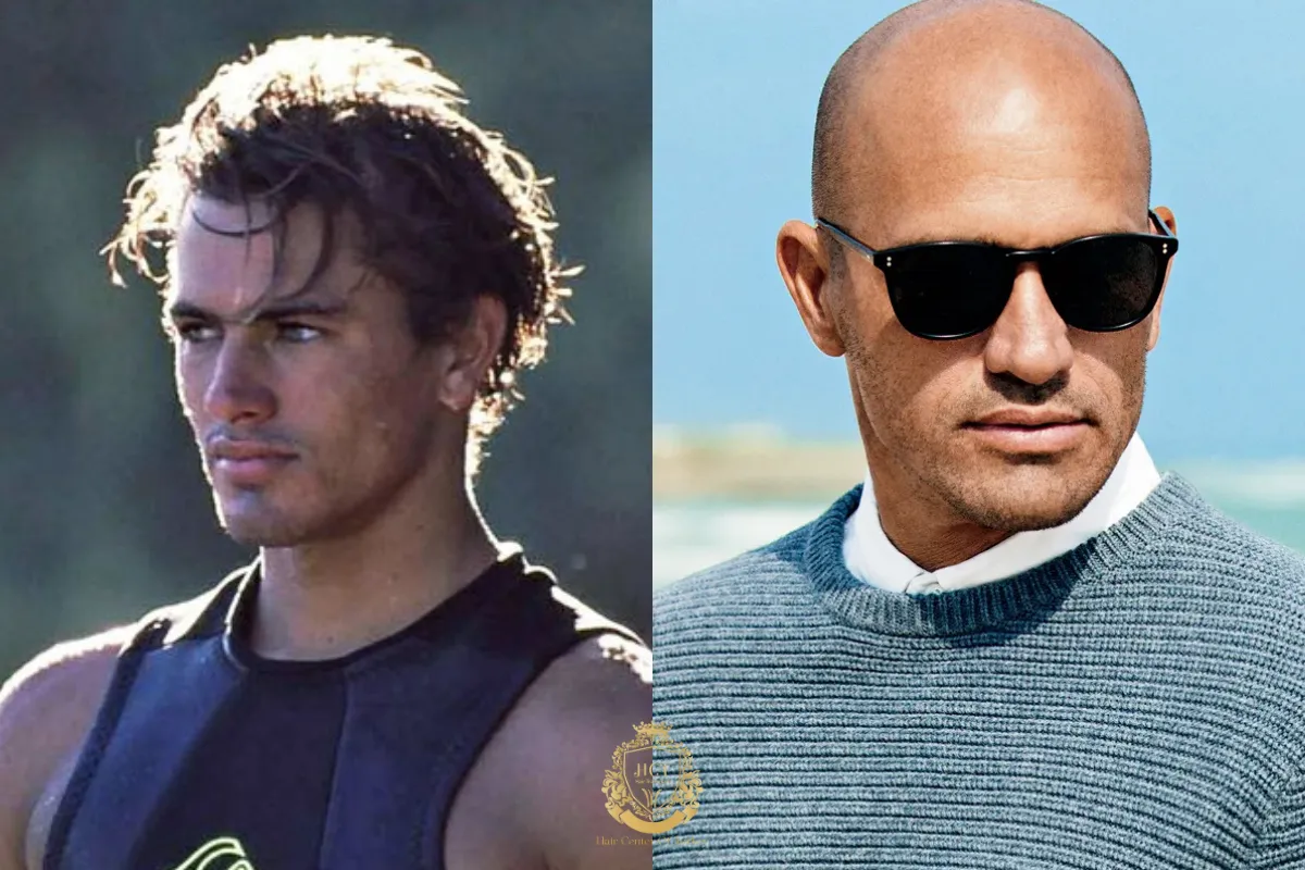 kelly slater bald actors
