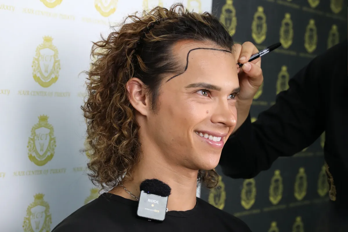 why choose hair transplant in turkey