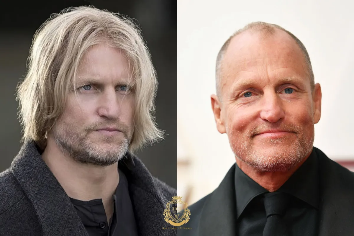 woody harrelson bald actors