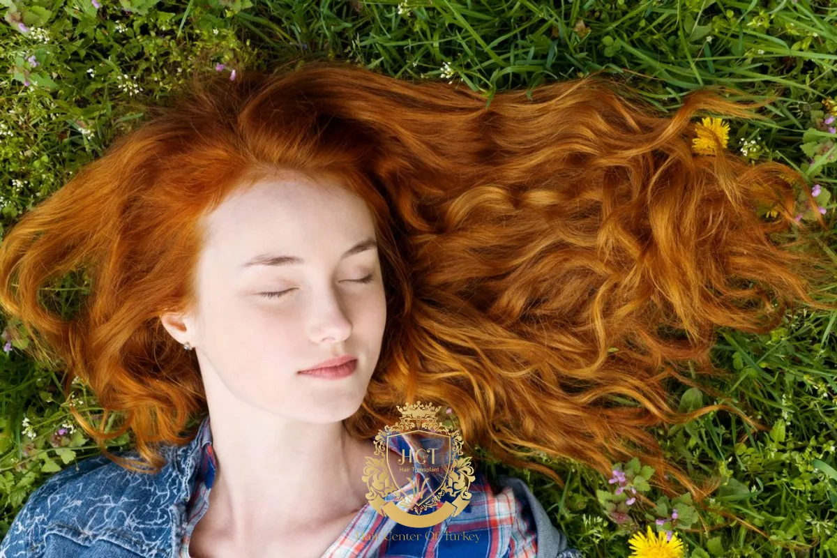 1_result receding hairline