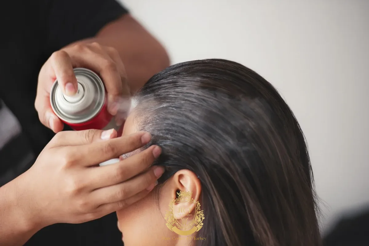 receding hairline