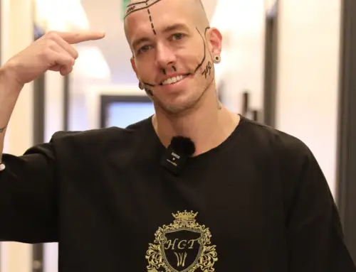 ¿Por qué Turquía es un destino tan popular para los trasplantes capilares?