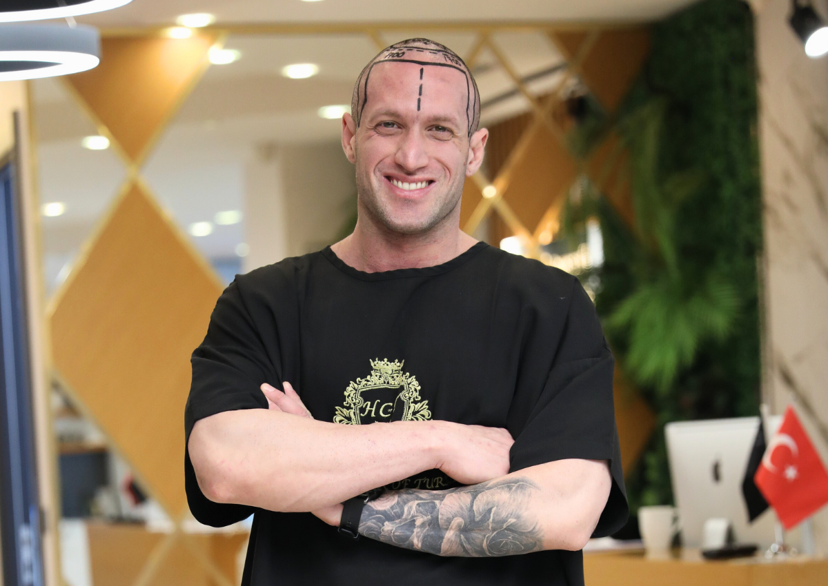 hair transplant in istanbul