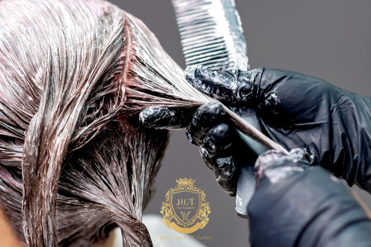 1_result receding hairline