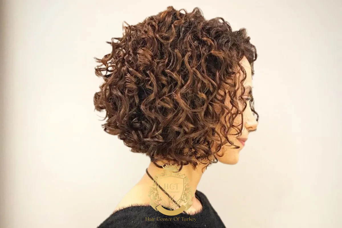 1_result receding hairline