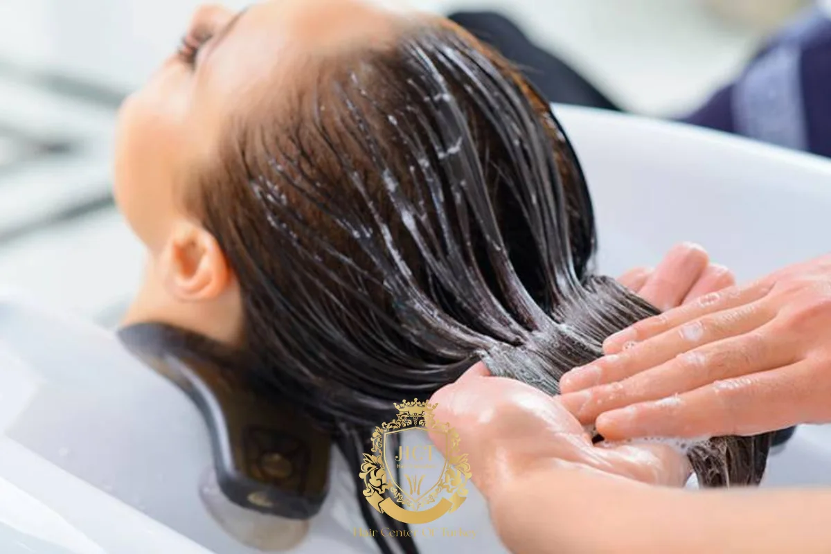 2_result receding hairline