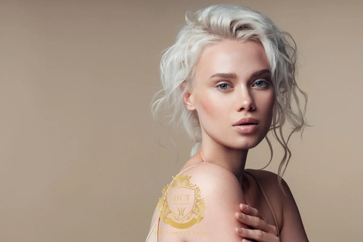 2_result receding hairline