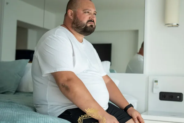 Pessoas obesas podem se submeter a transplante capilar?