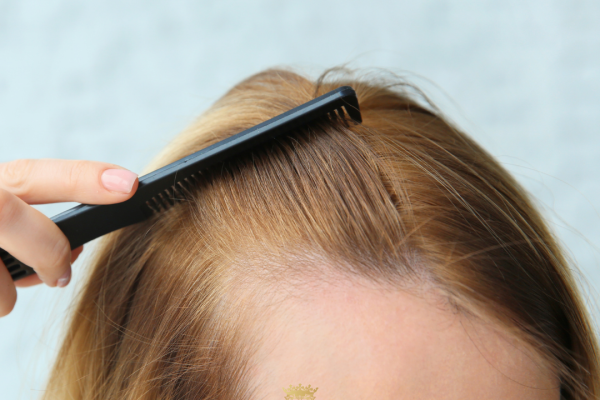 Les coupes de cheveux les plus flatteuses pour les femmes aux cheveux clairsemés | Coiffures qui donnent du volume