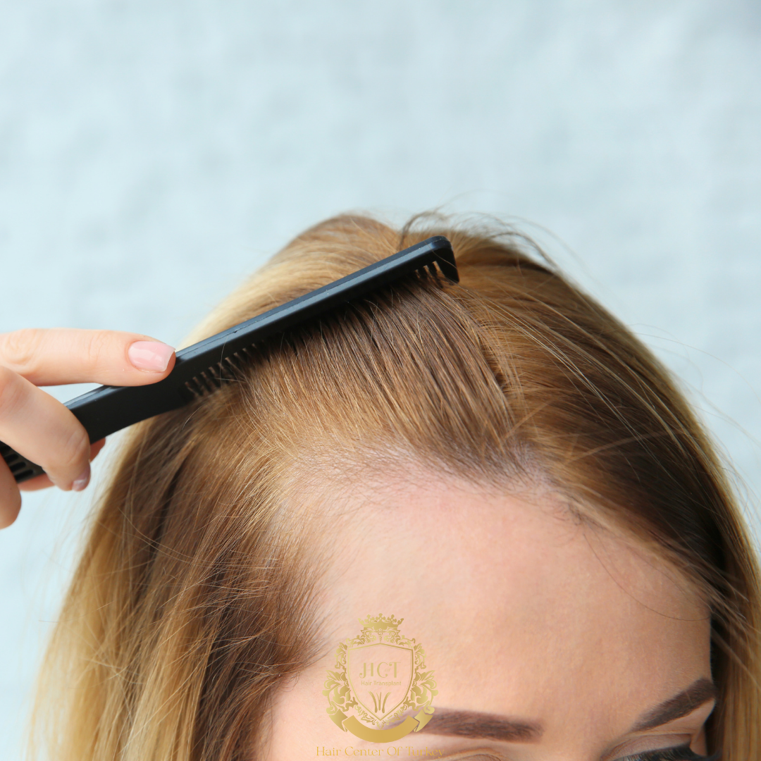 What Are the Best Haircuts for Women with Thinning Hair?