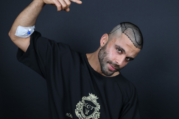 Können Patienten mit hohem Cholesterinspiegel eine Haartransplantation erhalten?